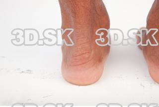 Foot photo reference 0002